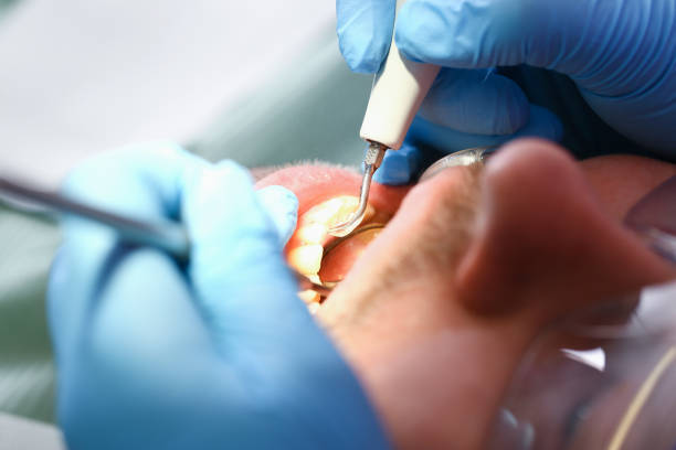 Best Pediatric Emergency Dentist in Port St John, FL