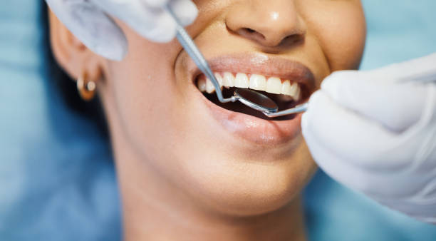 Best Orthodontic Emergency Dentist in Port St John, FL